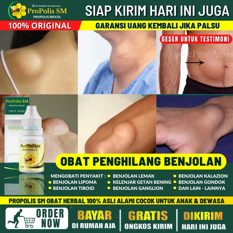 Obat Penghancur Tumor Jinak di Punggung Secara Alami, Obat Benjolan di Punggung Terasa Pegal, Benjol