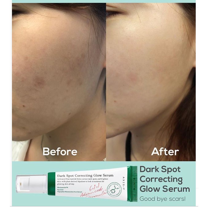 Axi//s---Y Dark Spot Correcting Glow Serum 50ml-Penghilang Flek Hitam Mencerahkan Kulit Brightening Serum Pencerah Wajah Perawatan Kecantikan Perlakuan