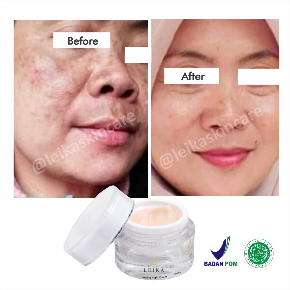 Sangat Ampuh Night Cream Penghilang Flek Hitam Di Wajah Krim Malam Menghilangkan Flek Hitam membande