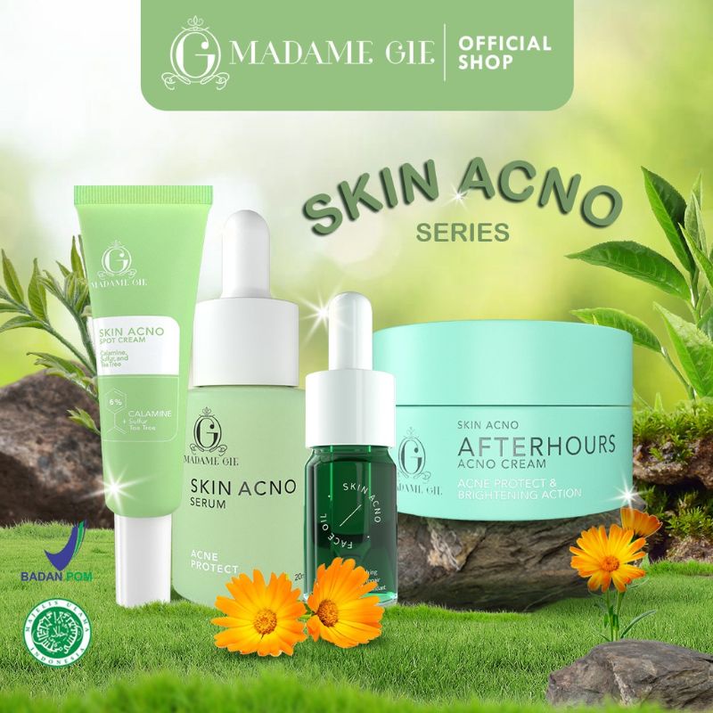 LIZBEAUTY - Madame Gie Madame Skin Acno Spot Cream - Acno Cream