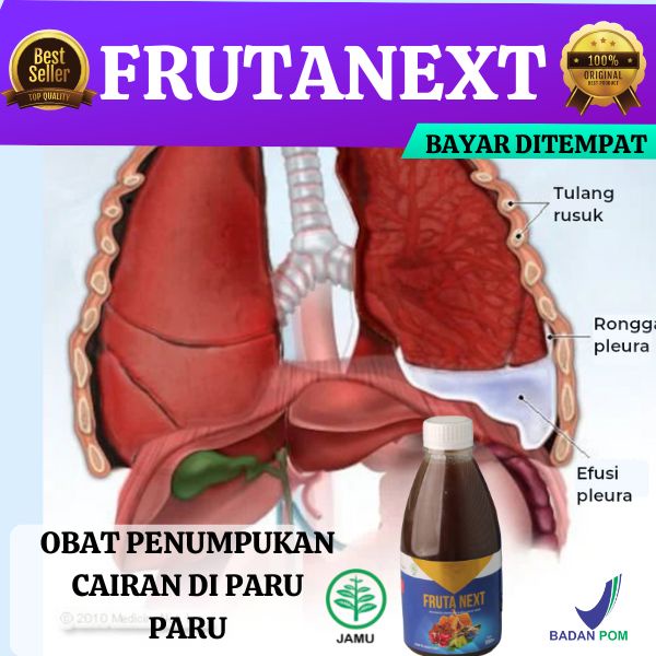FRUTA NEXT Obat Penumpukan Cairan Di Paru-Paru Efusi Pleura Edema Paru FRUTANEXT ORIGINAL BPOM