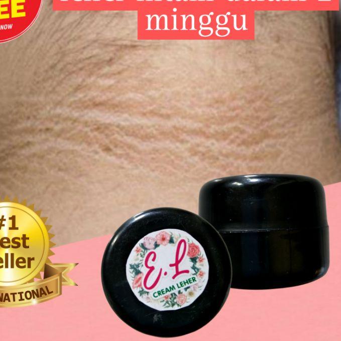 limited STOCKE.L cream pemutih leher paling ampuh dan cepat|RA3