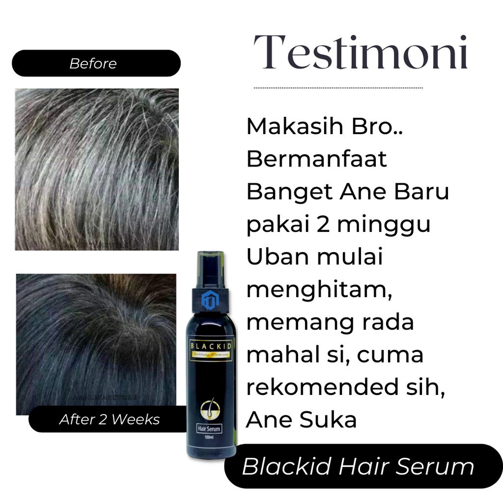 Serum Rambut Rontok Parah  Pemanjang Rambut Serum Penghitam Rambut Pria Dan Wanita Anti Rontok Dan Penghilang Uban Cepat Permanen 100ml Blackid Hair Serum Premium Original Bpom