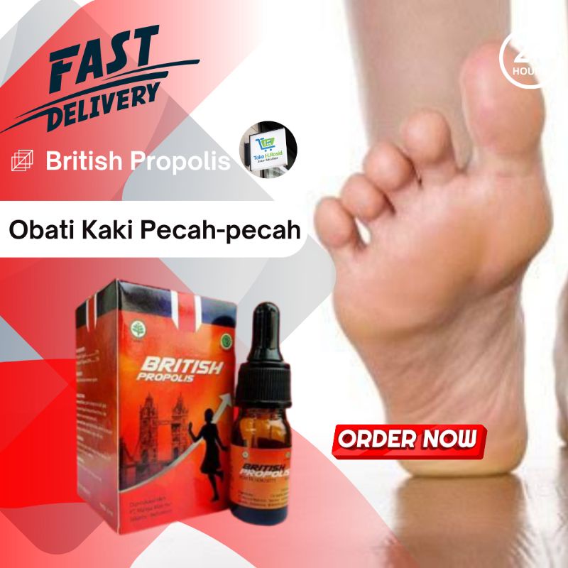 British Propolis 6ml Obat Kulit Kaki Pecah dan Kering Dewasa Pembersih Olesan Psoriasis Bekas Luka B