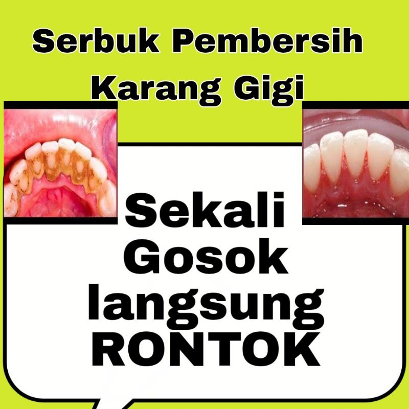 Serbuk perontok Karang gigi