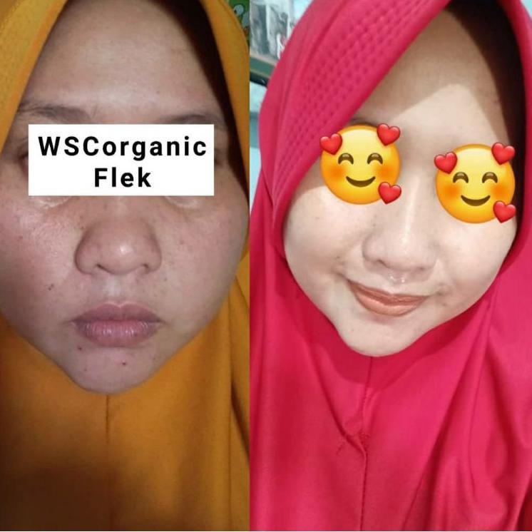 Big Sale--[ FREE SERUM ] WSC ORGANIC SKINCARE