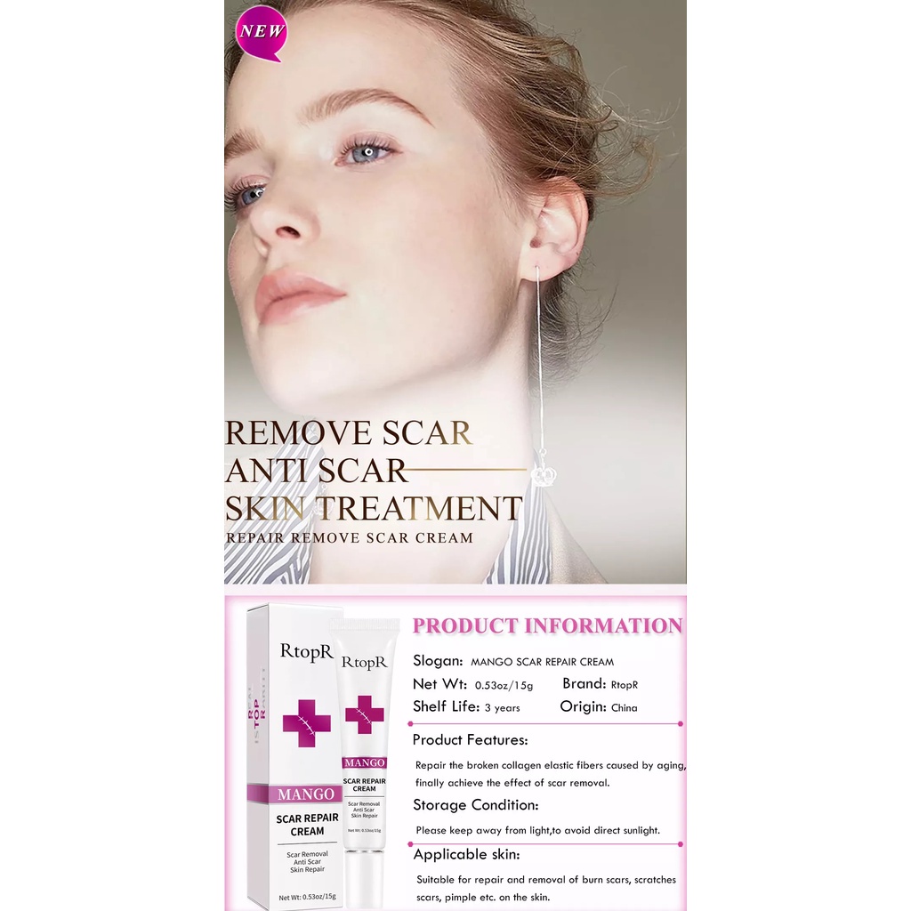 RtopR SCAR REPAIR CREAM Acne Scar Treatmen Repair Skin Care Stretch Burn Scar Remover Skin Repair Spots Body Skin Cream 15g