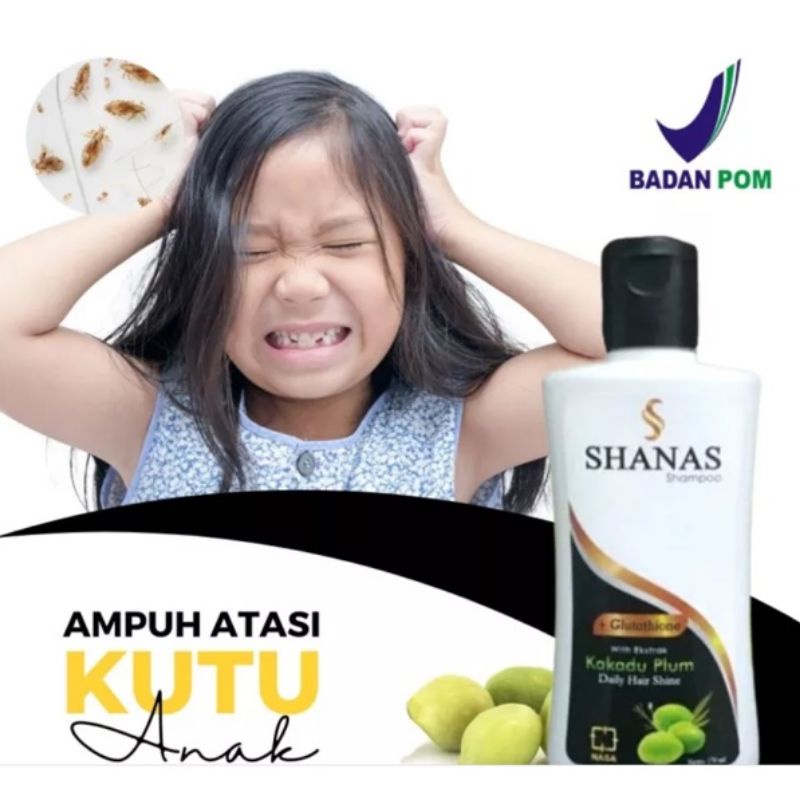 MO Shampo Shanas NASA Anti Kutu Shampo Kutu Rambut/ Shampo Shanas Sampo Kutu Rambut