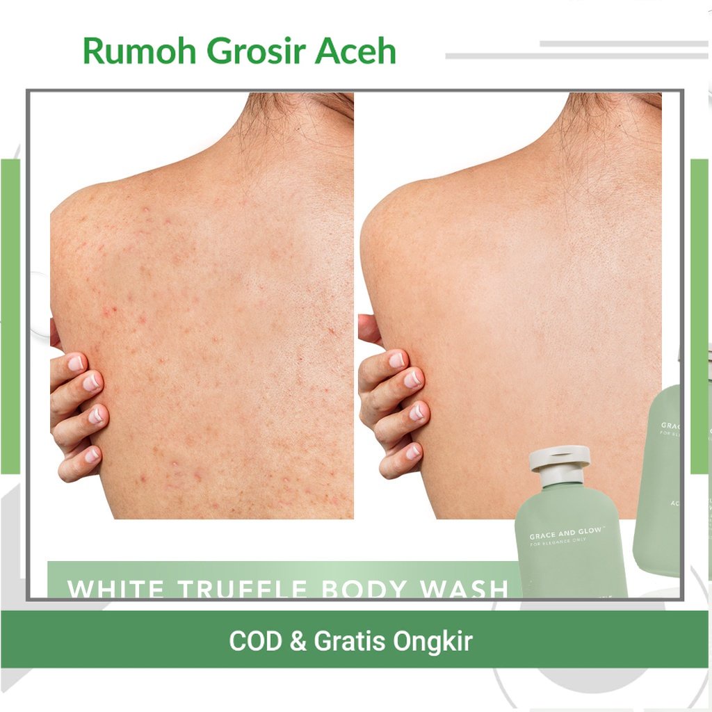 (ACEH)  White Truffle Acne Body Wash GRACE & GLOW