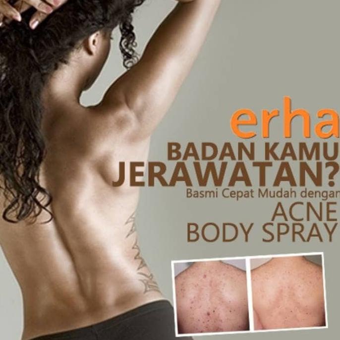 ERHA ACNE BACK SPRAY ORIGINAL - OBAT JERAWAT DI PUNGGUNG / BADAN