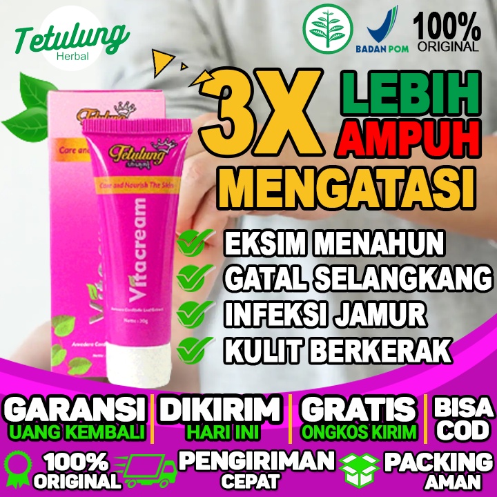 obat eksim di tangan obat eksim di selangkangan obat eksim di wajah obat eksim di kepala