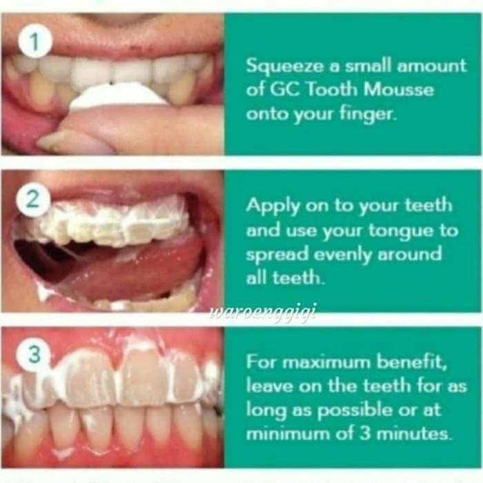 GC TMP / GC Tooth Mousse Plus / GC ToothMousse Plus