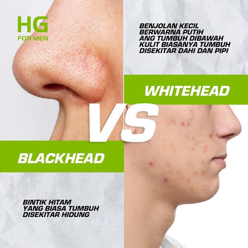 HG For Men Facial Wash Acne Care &amp; Oil Control 100ml