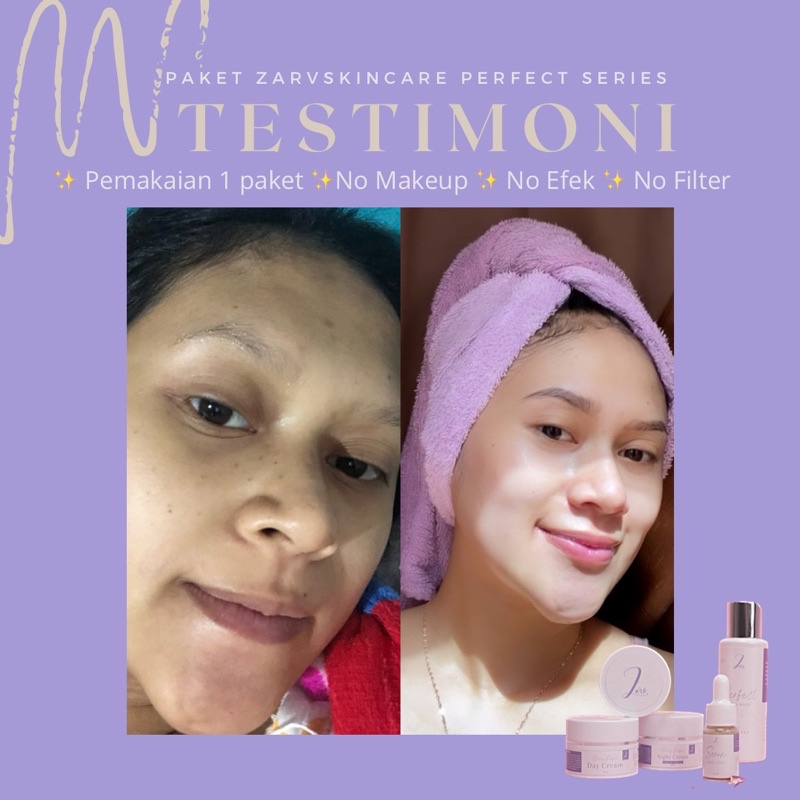 TERLARIS‼️ PAKET GLOWING PERFECT SERIES ZARV/ PAKET WHITENING / PAKET ACNE GLOWING / PAKET BRIGHTENING// zarv.skincare