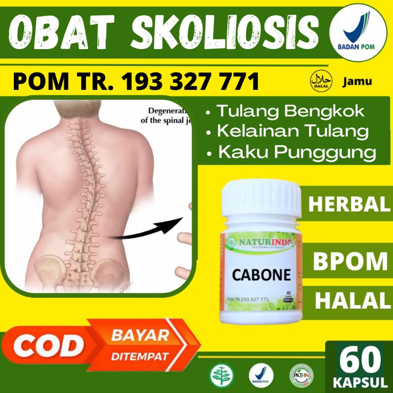 Obat Skoliosis Tulang Bengkok Pada Anak Dan Dewasa Kelainan Tulang Belakang Herbal Kalsium