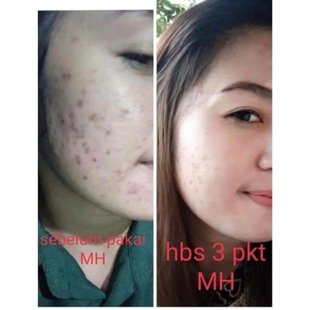 mh kosmetik dan mh miracle