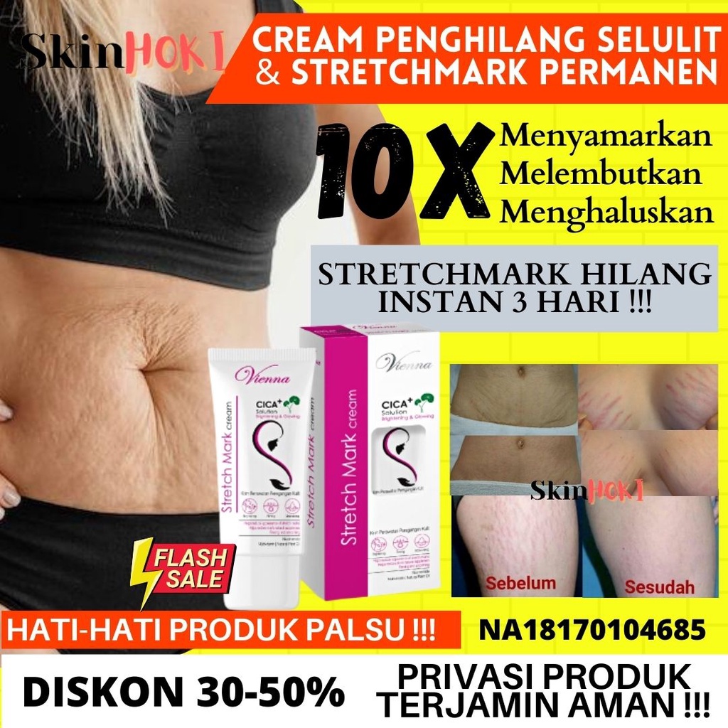 PENGHILANG STRETCH MARK PERMANEN AMPUH PENGHALUS KULIT VIENNA STRETCHMARK CREAM 80ML PERAWATAN KULIT ORIGINAL BPOM