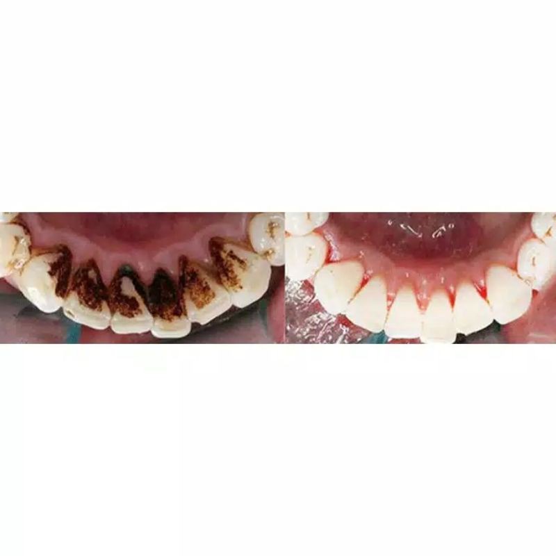 YABANJING WHITENING TEEHT / PEMUTIH GIGI YABAN TOOTH BADAN 10ML YABAN/ YA BAN