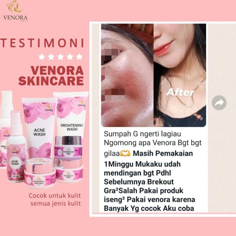 GRATIS ONGKIR [TERLARIS] PAKET BRIGHTENING VENORA SKINCARE MENGHILANGKAN FLEK ,MEMUTIHKAN,MENGGLOWIN