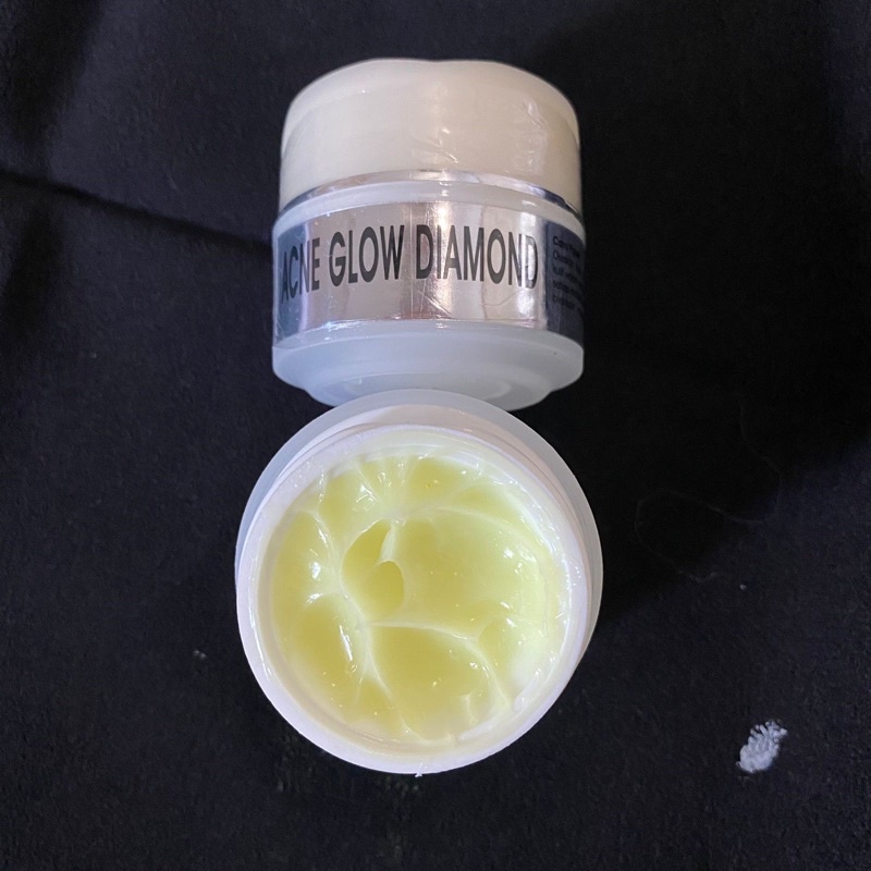 CREAM MALAM ACNE GLOW DIAMOND/cream acne diamond/acne glow/penghilang jerawat ampuh