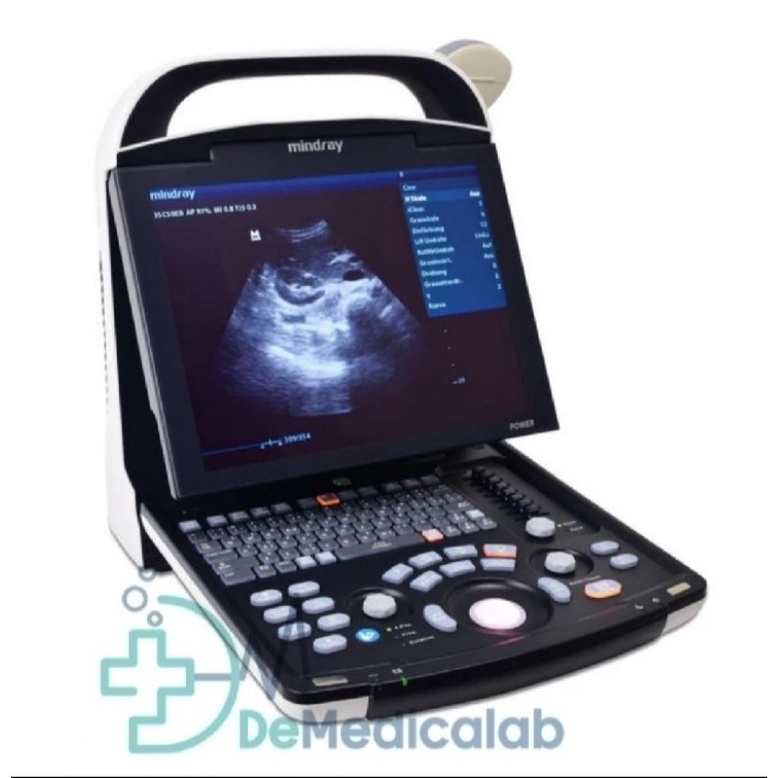 USG 2 Dimensi Mindray DP 10