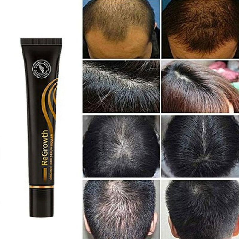 penumbuh rambut / regrowth organic hair serum roller