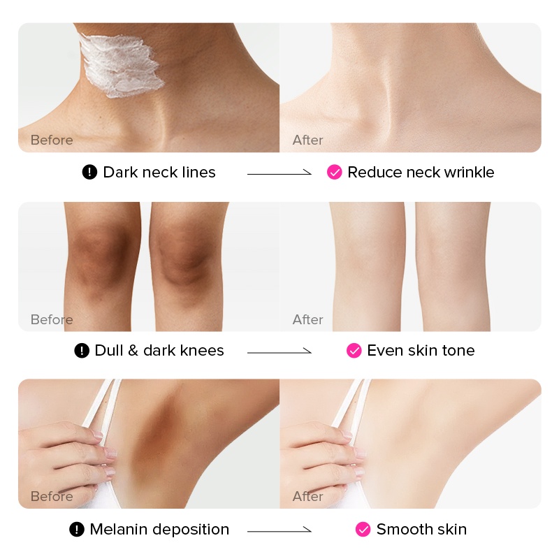 LAIKOU Niacinamide Body Cream Mencerahkan Kulit Ketiak Anti-Aging Mengurangi Kerutan 100ml