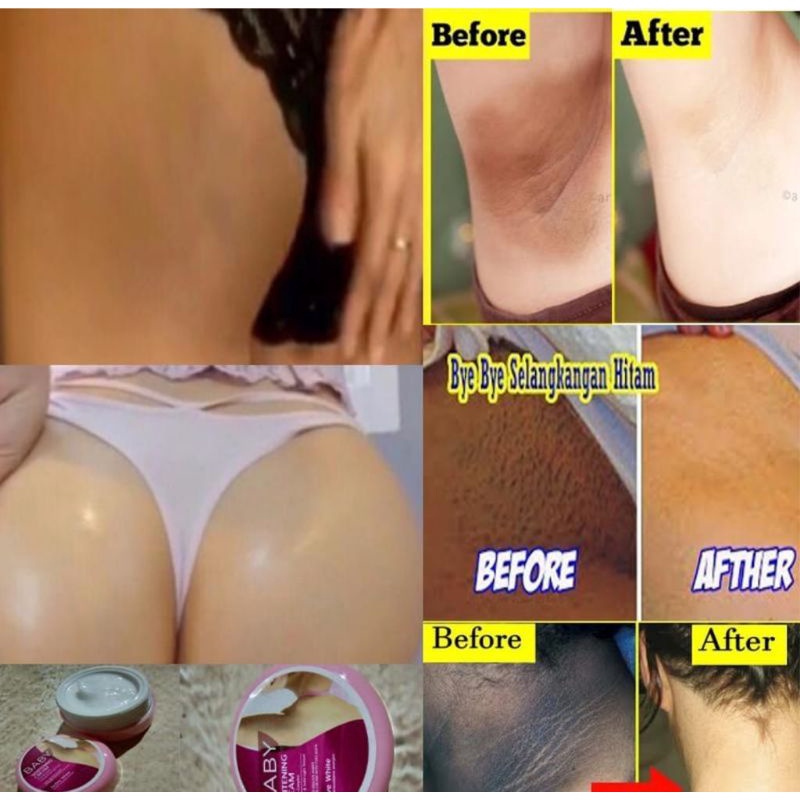 BABY WHITENING CREAM - CREAM KETIAK LEHER LIPATAN DLL