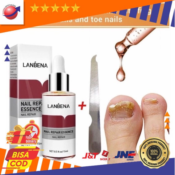 LANBENA Nail Repair Essence Serum Vitamin Perawatan Kuku Jamuran Manicure Pedicure COD
