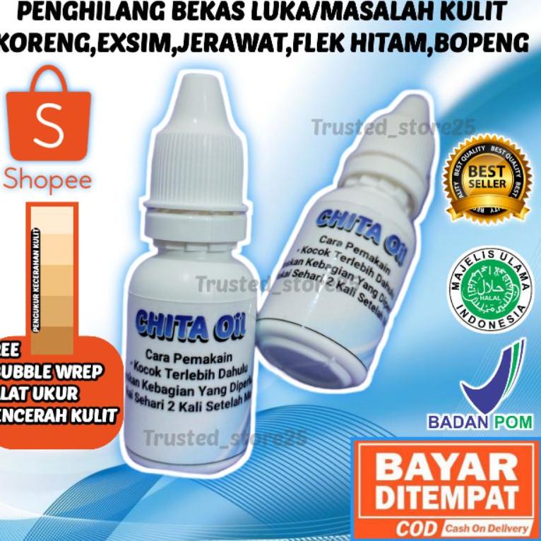 y7❇Best Product✰ (BISA COD) CHITA OIL PENGHILANG BEKAS LUKA, KULIT KORENG, EXSIM, JERAWAT, FLEK HITA