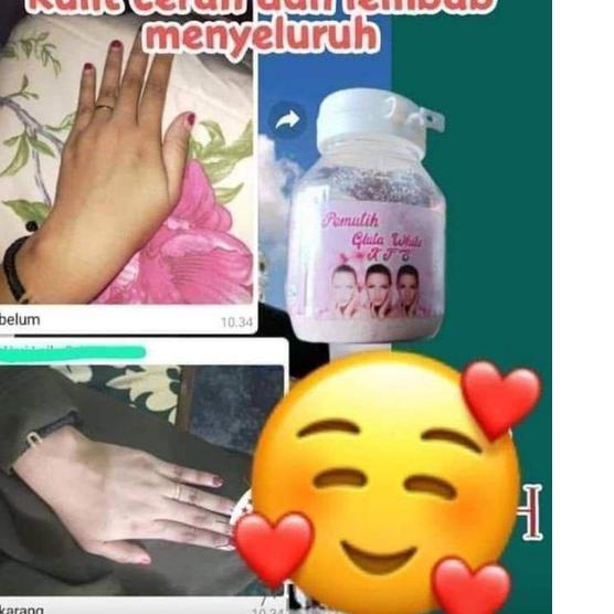 SALE✅GLUTA KFS/SUSU PEMUTIH KFS ORIGINAL|KD1