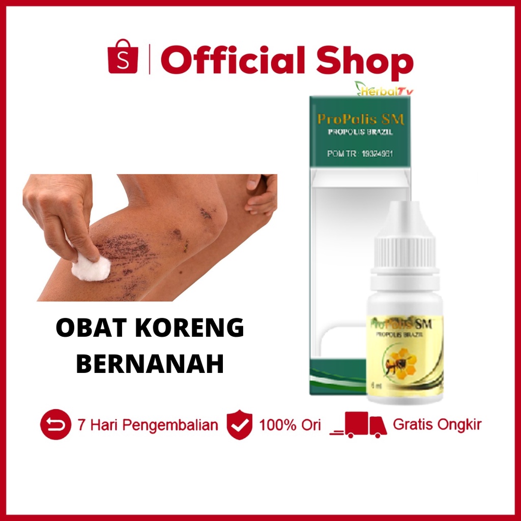 Obat Koreng Bernanah Alami Di Kaki Di Kepala Penghilang Bekas Luka Koreng anak dewasa propolis