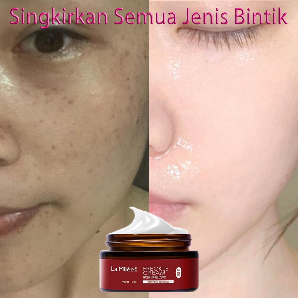 Cream pemutih wajah Krim bintik pemutih 30G Singkirkan melasma, bintik-bintik, bintik matahari, bint