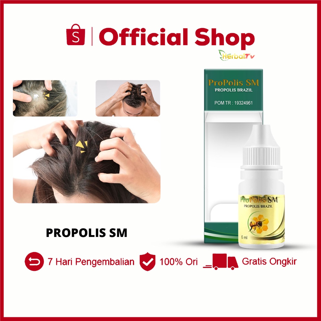Obat Alami Gatal Kulit Kepala Ketombe Berkerak Jamur Kulit Kepala Infeksi Kulit Kepala Kulit Kepala 