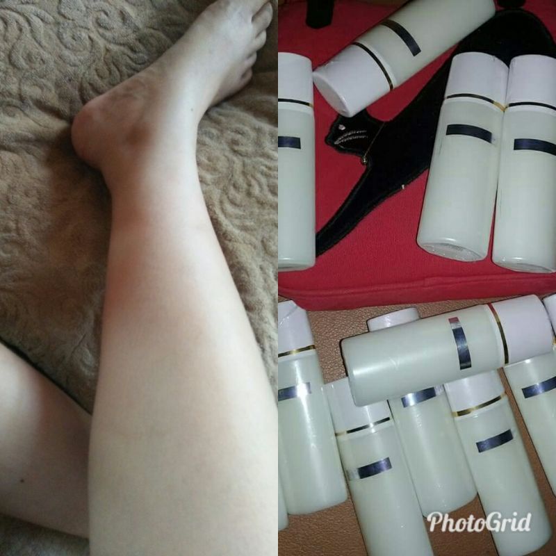 Lotion pemutih anggur