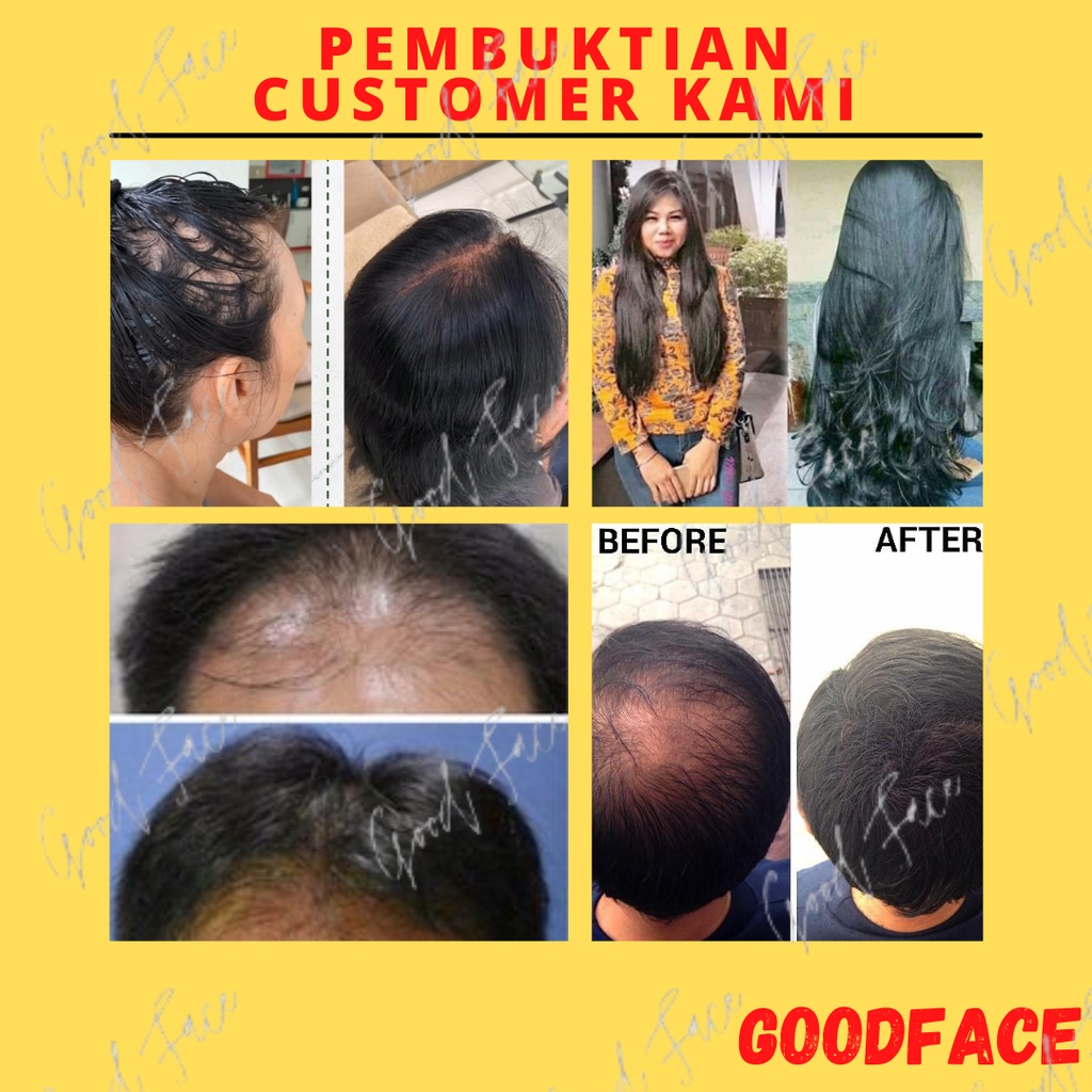 SHAMPOO METAL 60ML ORIGNAL PENUMBUH RAMBUT AMPUH SAMPO METAL TREATMENT RAMBUT PERAWATAN RAMBUT