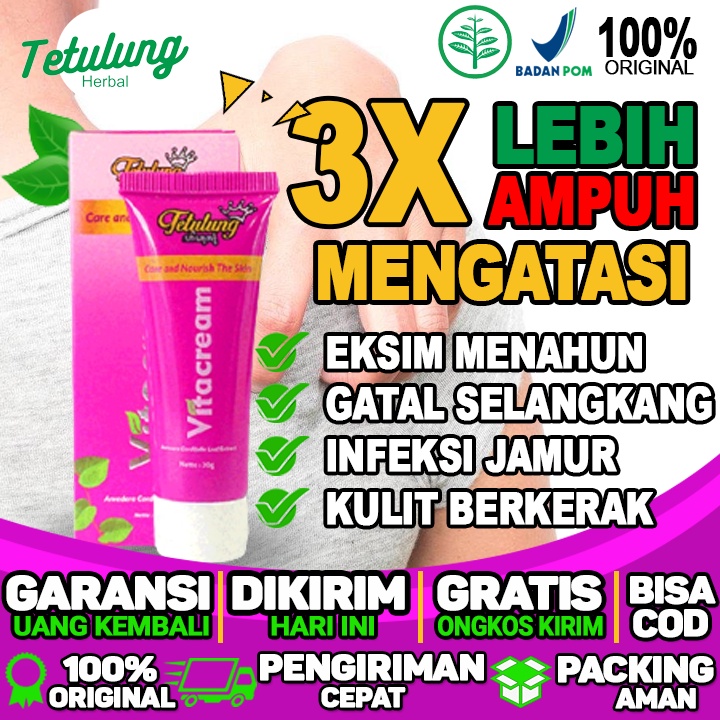 Obat Gatal Selangkangan Jamur dan infeksi menahun menghilangkan gatal selangkangan