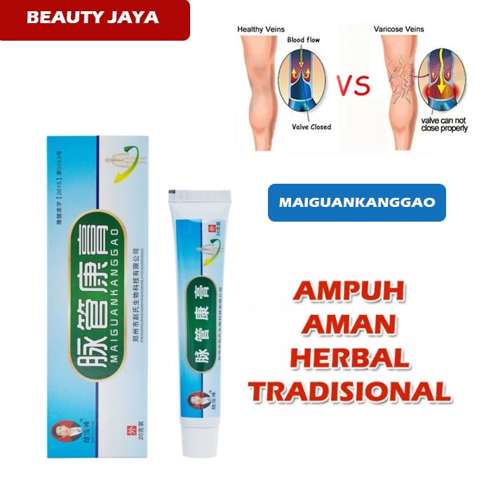 Beauty Jaya - Salep Varises Obat China Maiguankanggao Original Obat Varises Bengkak Benjolan Buah Zakar