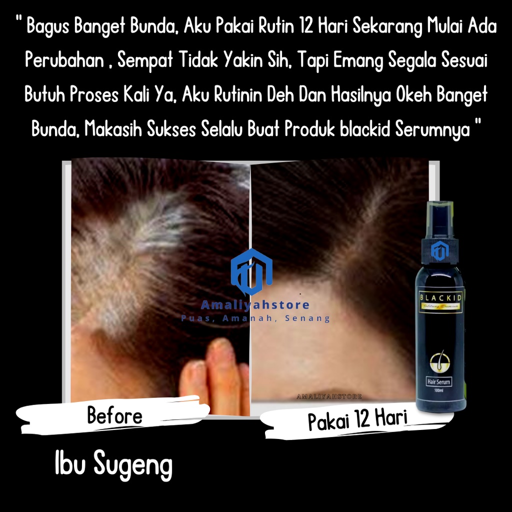 Serum Rambut Rontok Parah  Pemanjang Rambut Serum Penghitam Rambut Pria Dan Wanita Anti Rontok Dan Penghilang Uban Cepat Permanen 100ml Blackid Hair Serum Premium Original Bpom