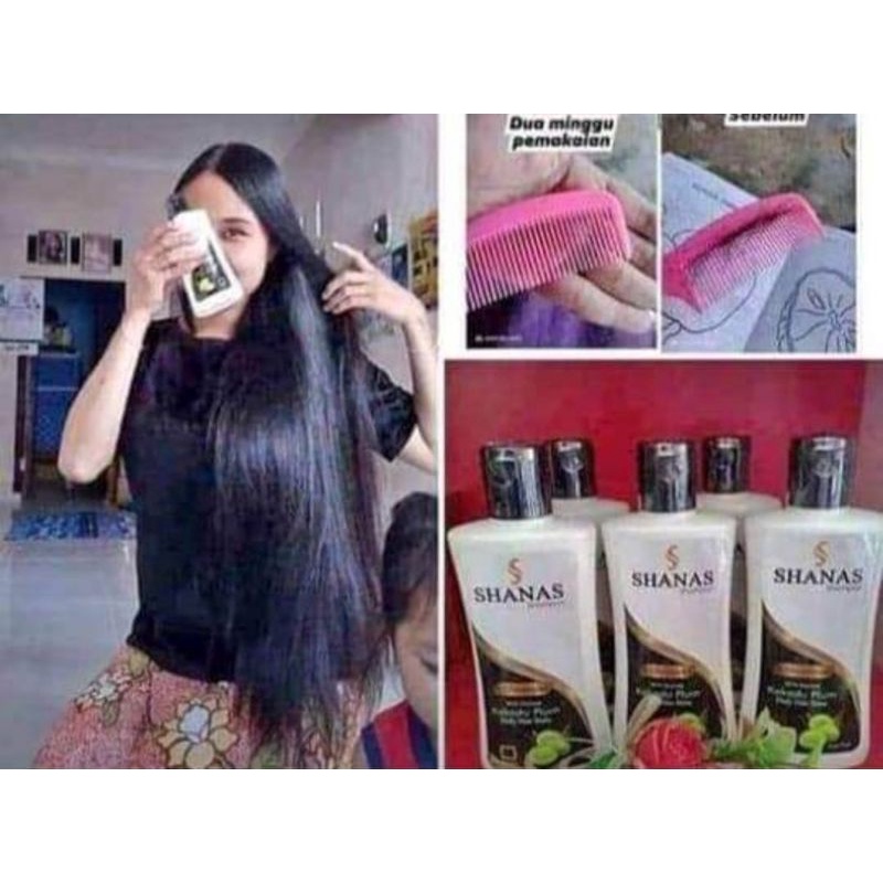 Sampo Anti Kutu Dan Ketombe SHANAS NASA
