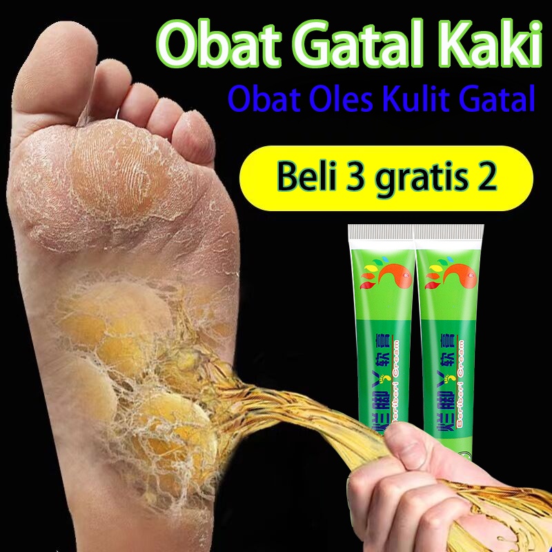 Jual Obat Oles Kulit Gatalobat Gatal Kakiobat Gatal Di Sela Jari Kaki Dan Tangansalep Gatal 0100