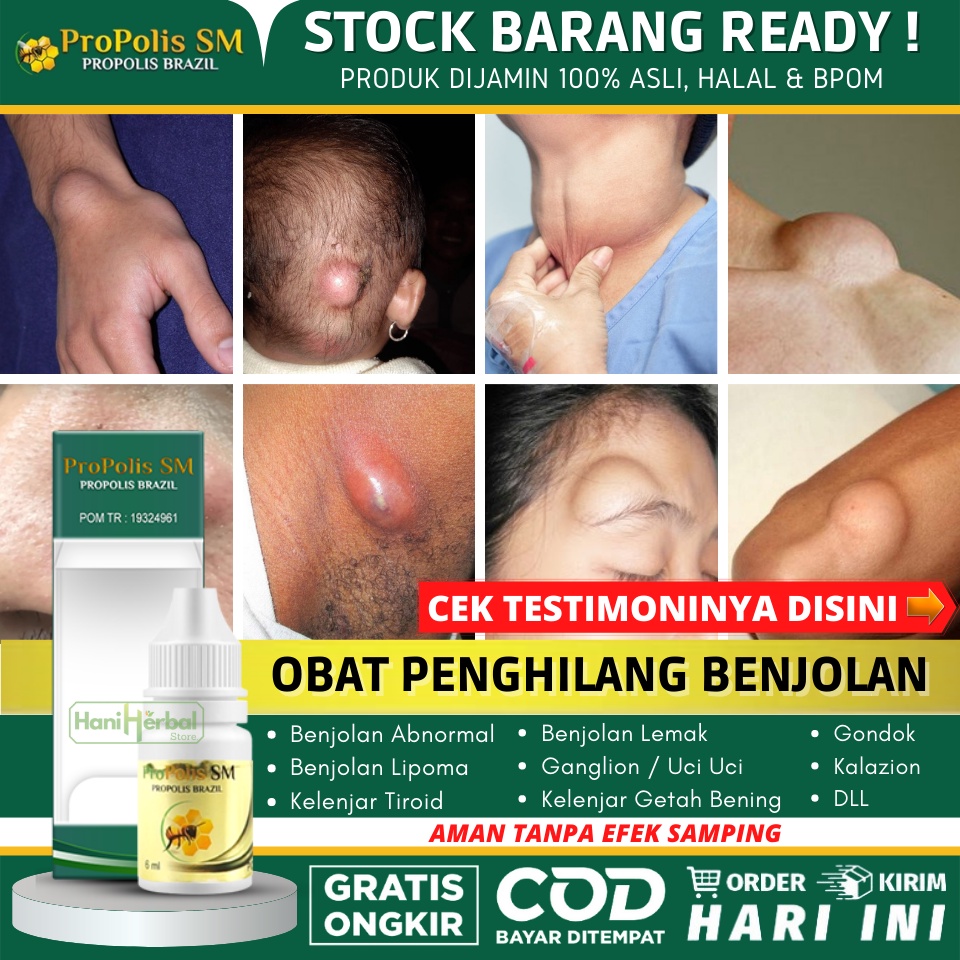 Obat Benjolan Oles Herbal 100%, Obat Benjolan di Leher / Punggung / Belakang Telinga / Tangan / Dahi