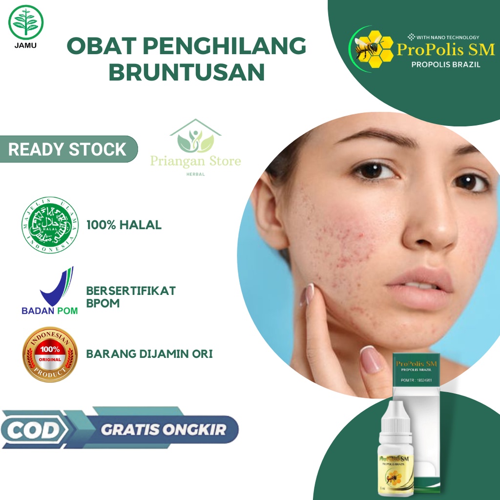 Obat Penghilang Bruntusan, Bintik Merah di Kulit, Jerawat Pasir, Bruntusan di Jidat, Bruntusan di Wa