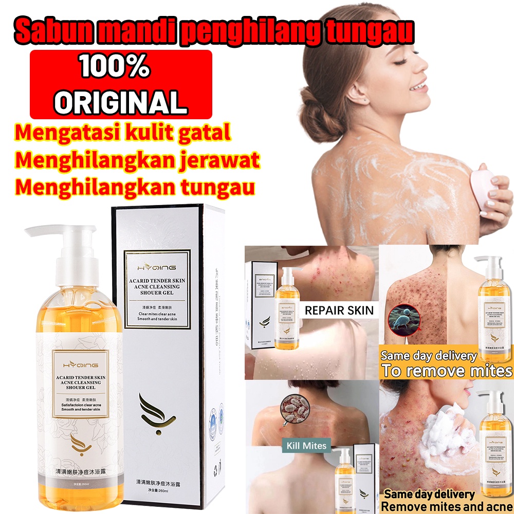 Sabun mandi penghilang tungau Membunuh bakteri Menghilangkan jerawat dan mengatasi gatal Kontrol minyak Wangi tahan lama Melembabkan Menghidrasi menghilangkan keratosis pilaris Body Wash Eksim Sabun Mandi Cair Mengatasi Jerawat/ Eksim