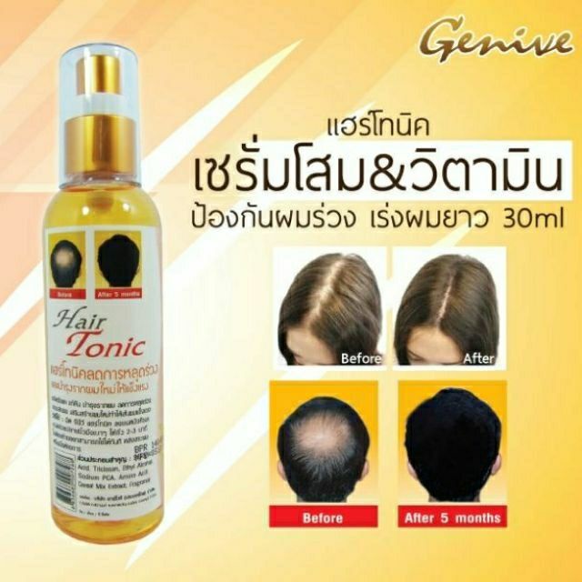 [TERMURAH] Genive Hair Tonic Spray | Menumbuhkan Rambut &amp; Mengurangi Kerontokan Rambut | Browit.id