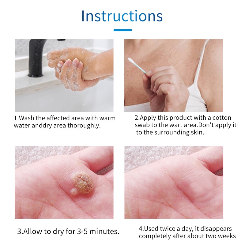 Sumifun Wart Remover &amp; Skin Tag Remover Ointment -Salep Obat Penghilang Kutil Dan Obat Penghilang Tahi Lalat - 20gr