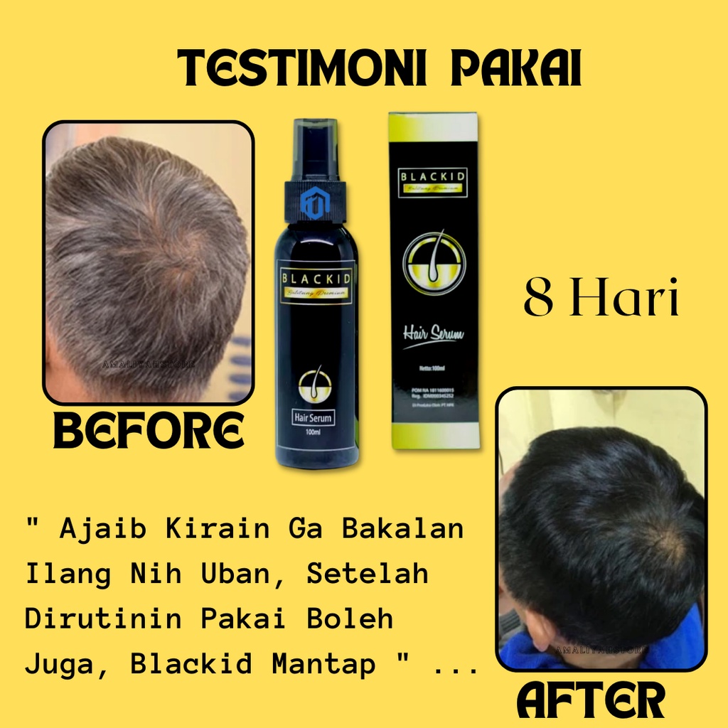 Serum Rambut Rontok Parah  Pemanjang Rambut Serum Penghitam Rambut Pria Dan Wanita Anti Rontok Dan Penghilang Uban Cepat Permanen 100ml Blackid Hair Serum Premium Original Bpom