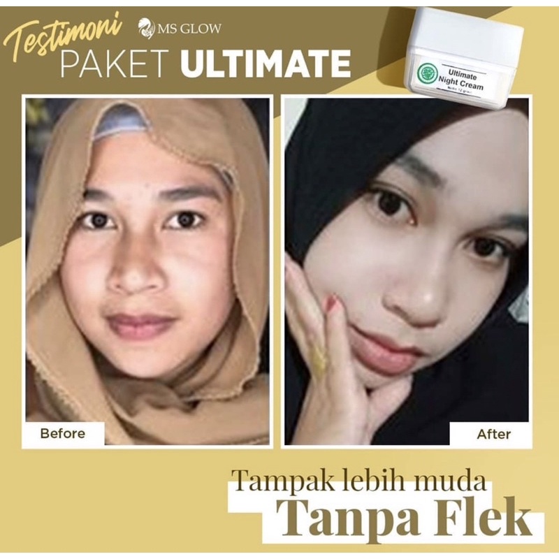 PAKET WAJAH ULTIMATE MSGLOW PAKET FLEK