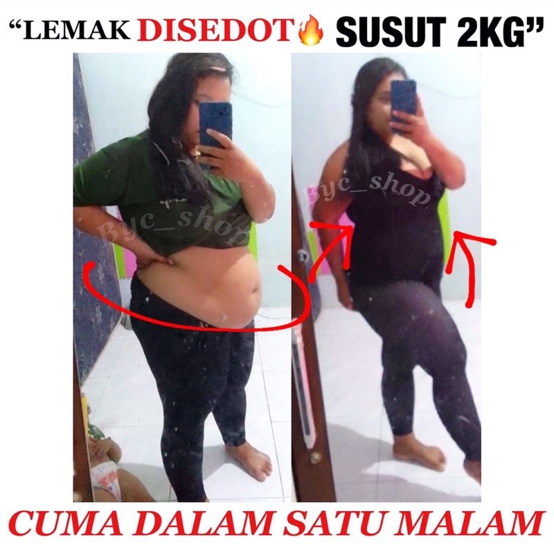 Korset SEDOT LEMAK AUTOSLIM ANTOINETTE