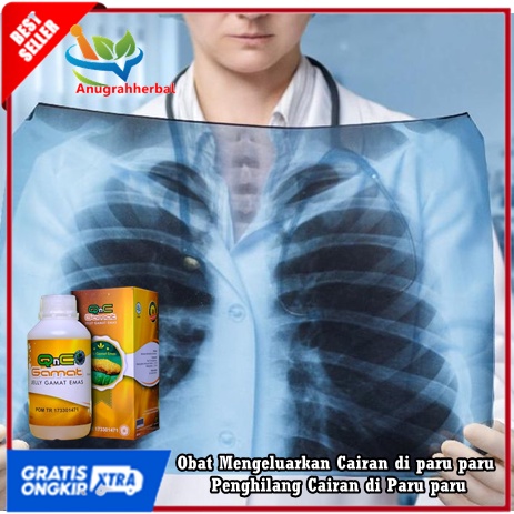 Obat Mengeluarkan Cairan di paru paru, Penghilang Cairan di Paru paru, Sesak Nafas Karena Paru paru 